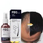 FEG Plus Hair And Beard Regrowth Spray Anti Hair Loss Formula With Minoxidil Redensyl And Natural Extracts - 50ML - Image 4