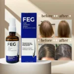 FEG Plus Hair And Beard Regrowth Spray Anti Hair Loss Formula With Minoxidil Redensyl And Natural Extracts - 50ML