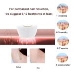 IPL Laser Hair Removal Handset System for Women & Men with Razor & Safety Glasses - Image 3